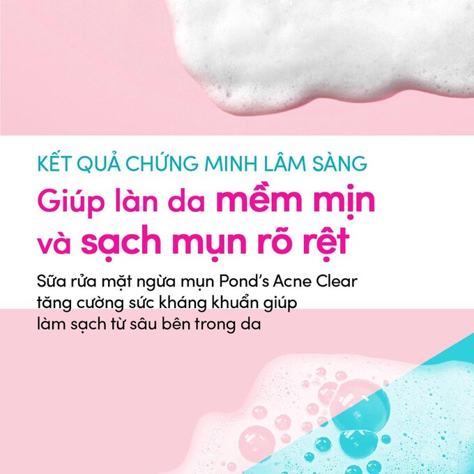 Sữa Rửa Mặt Pond's Sạch Sâu Ngừa Mụn 100g Acne Clear Facial Foam